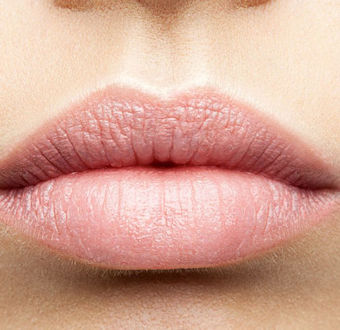 Lippen unterspritzen mit Hyaluron-Gel in Frankfurt