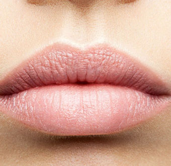 Lippen aufspritzen mit Hyaluron-Gel in Frankfurt