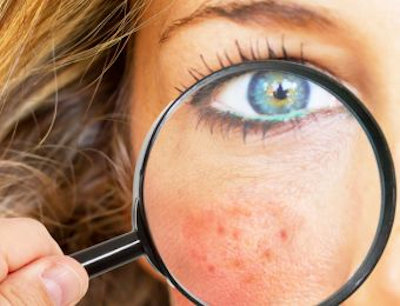 Skin diseases الأمراض الجلدية