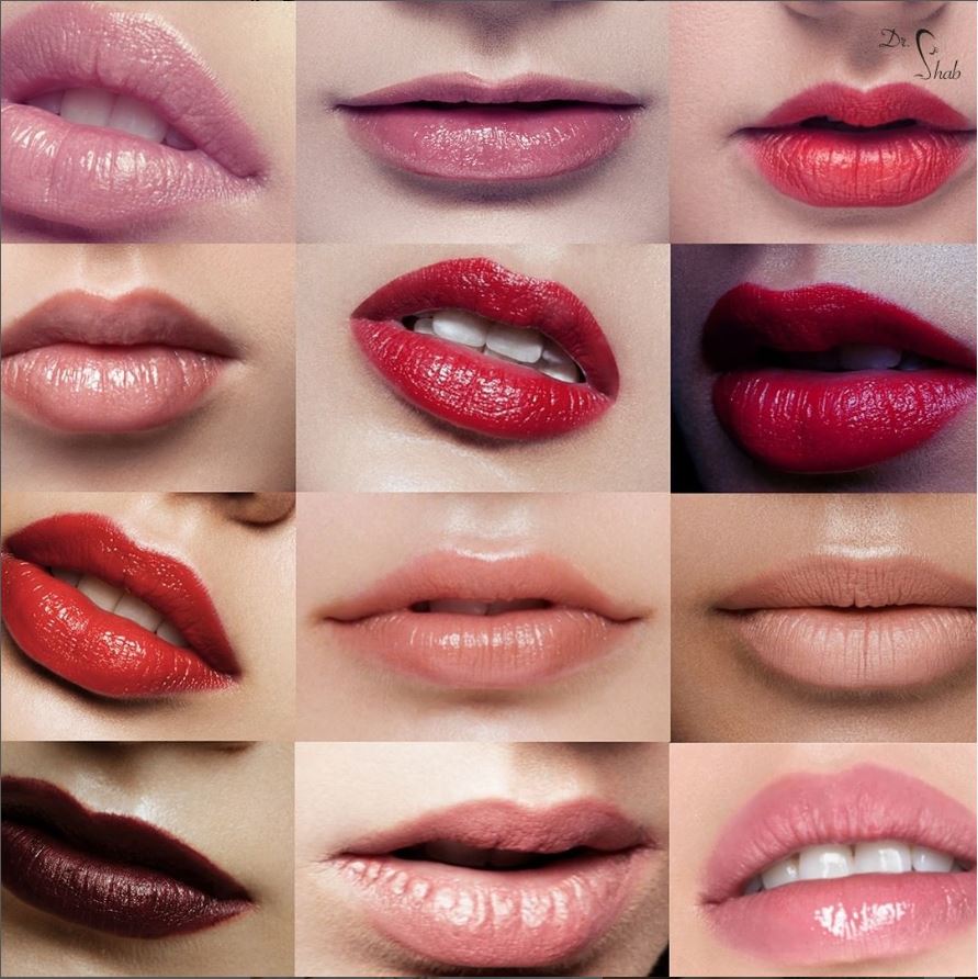 schöne Lippen nach Lippenvergrößerung