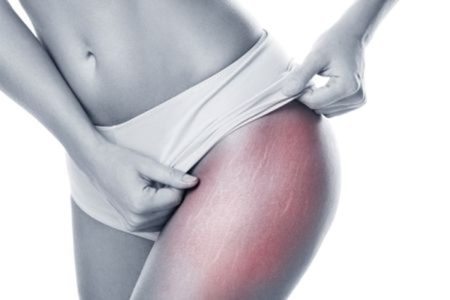 Frau mit Tuch nach Mesotherapie