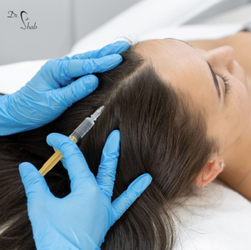 2023-08-09 14_43_26-Dr. Shab (@drshab_) • Instagram-Fotos und -Videos PRP-Behandlung gegen Haarausfall bei Hautarzt Dr. Shab in Frankfurt