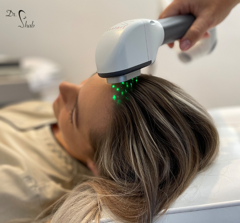 Laserbehandlung gegen Haarausfall mit Fotona Laser in Frankfurt Westend