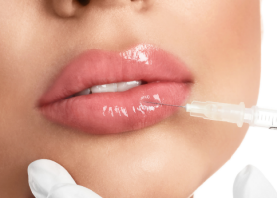 Lippen mit Hylase auflösen Lippenunterspritzung mit Hylase lösen